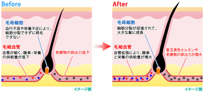 頭皮の血流アップbefore・after