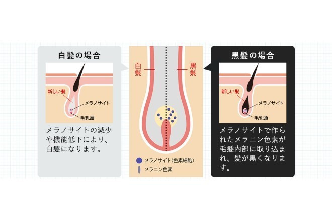 白髪ができるメカニズム