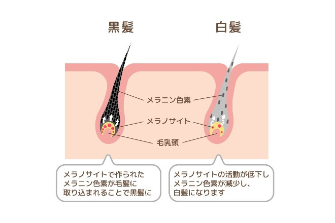 髪の毛が白髪になるメカニズム